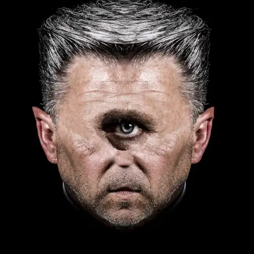 cyclops